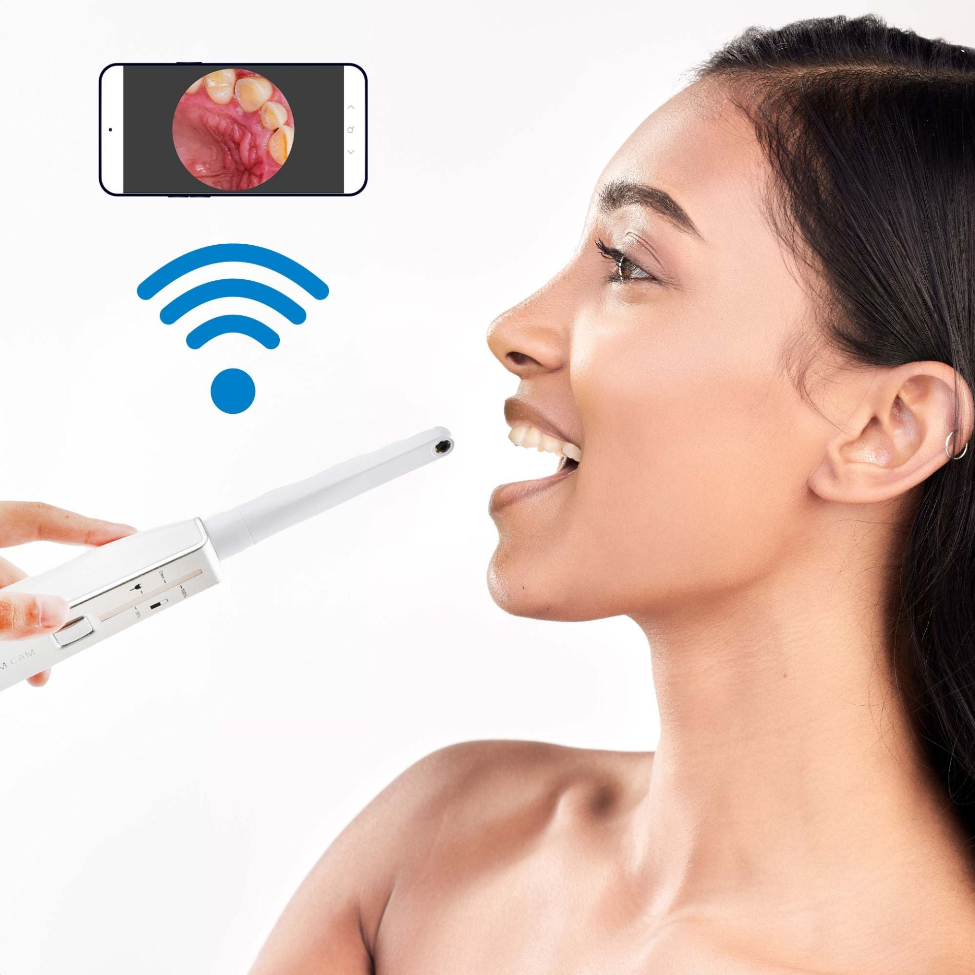 PlatinumCAM dental camera attachment
